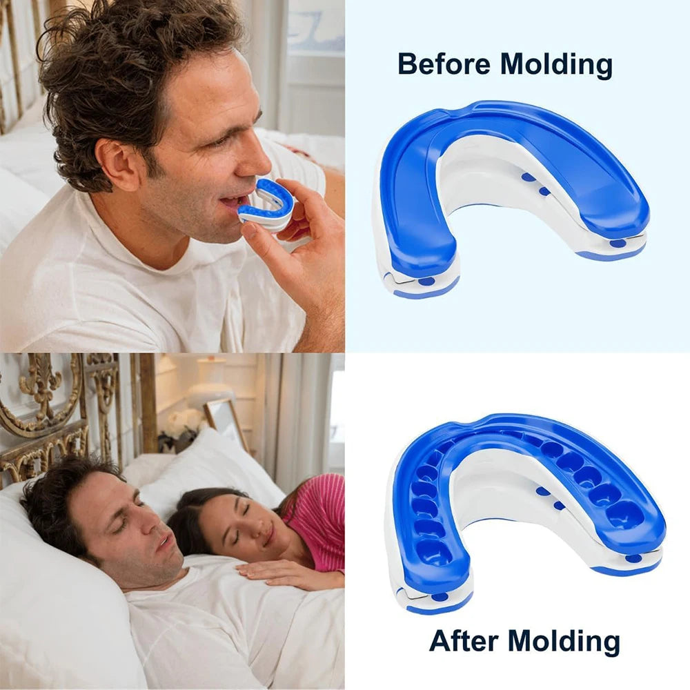 Adjustable Anti-Snoring Mouthpiece